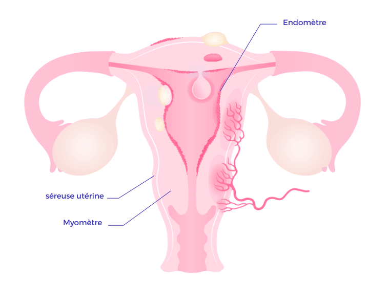 Schéma de l'utérus